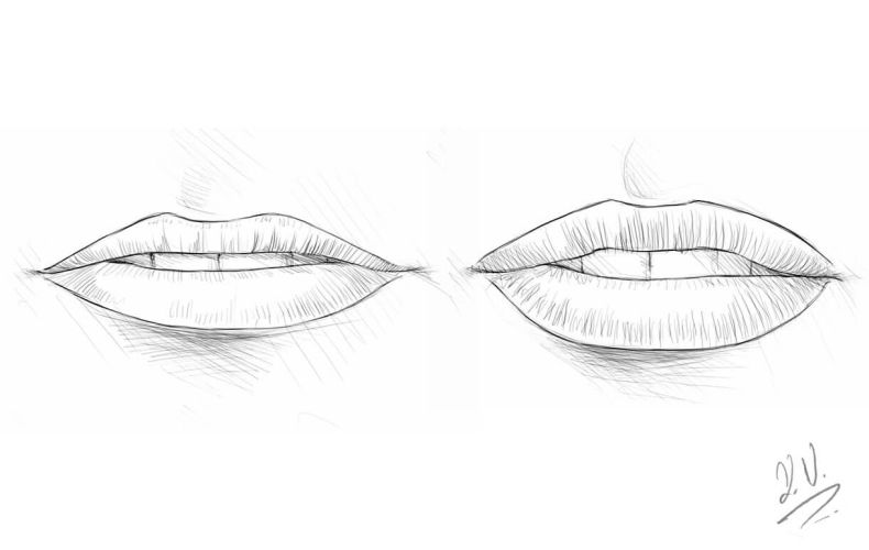 Lippenvergrösserung - Lippen aufspritzen
