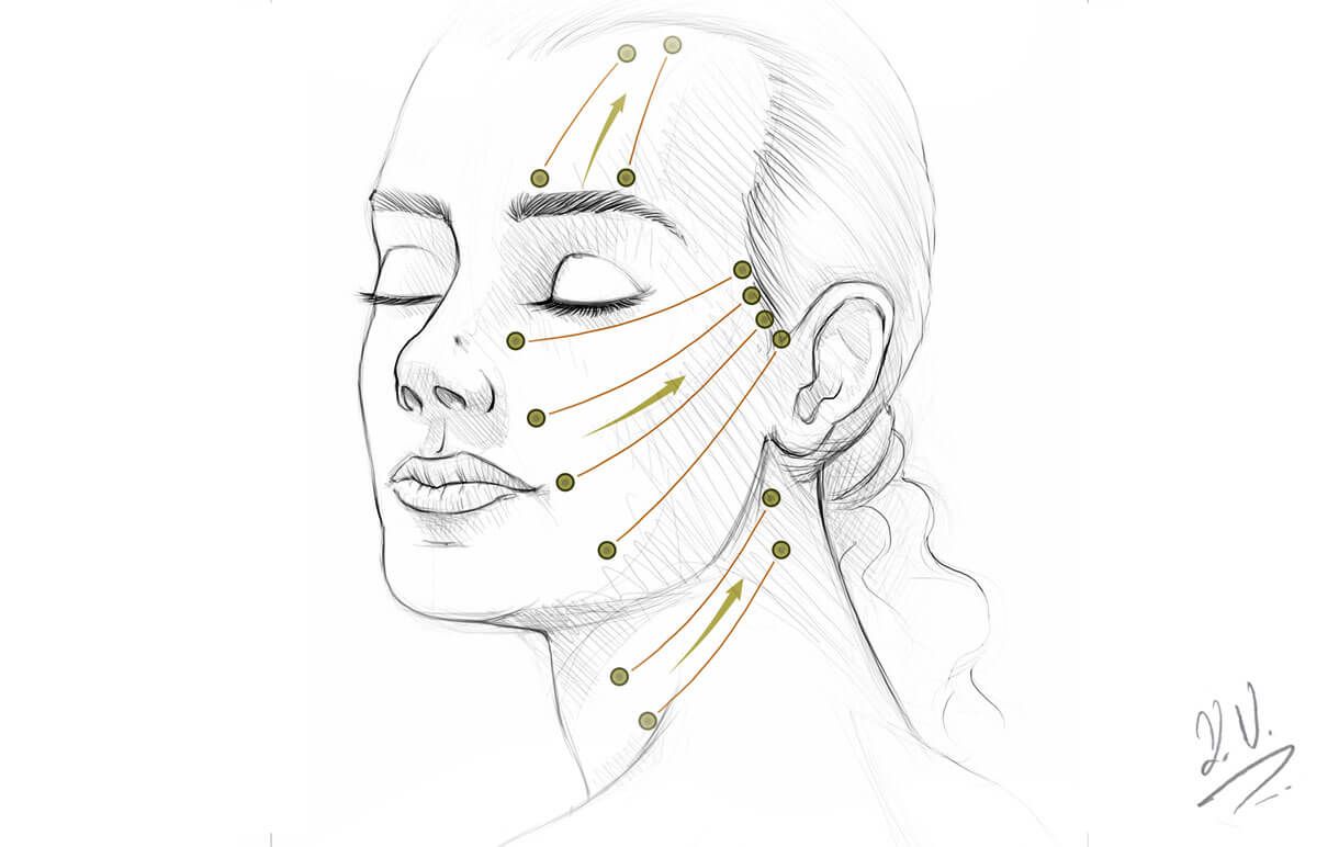 facial contouring with threads