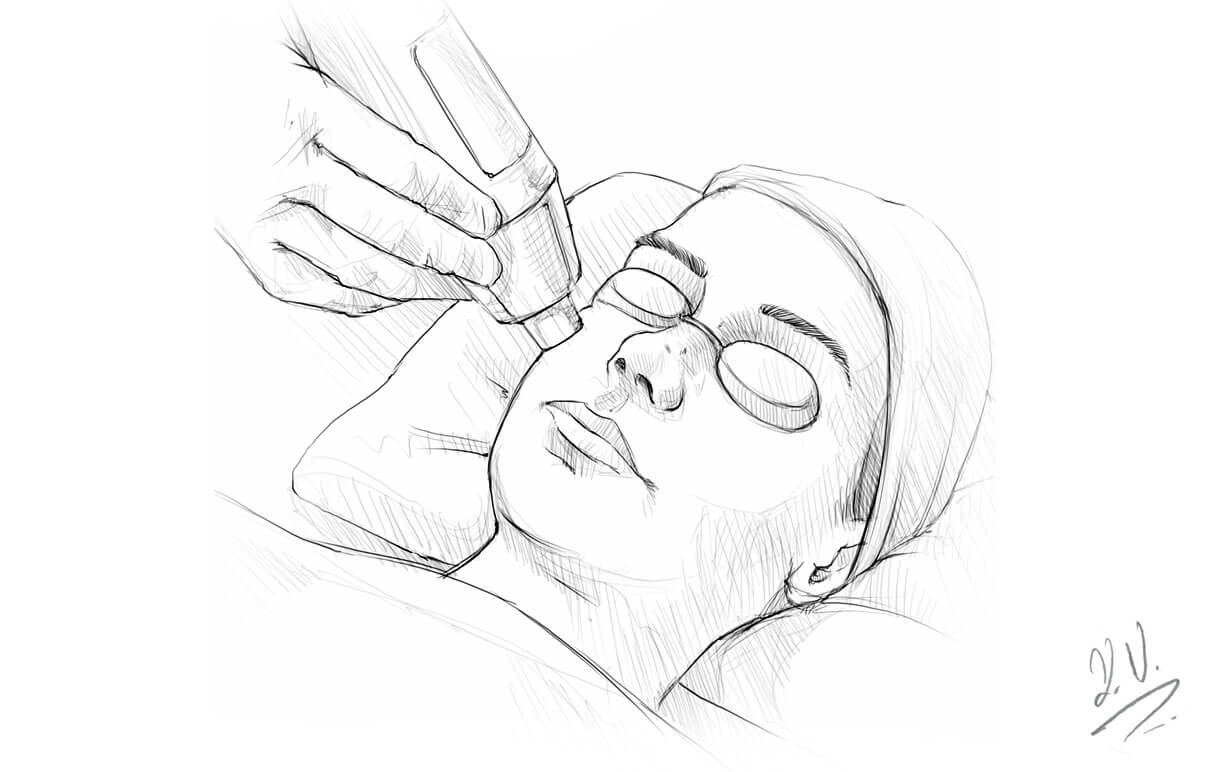 Skin rejuvenation with laser