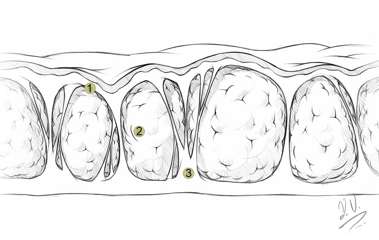 Cellulite behandlung Dr. Kelly