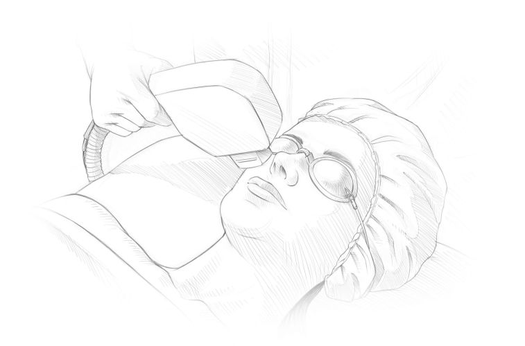 IPL Laser Dr. Kelly Zug