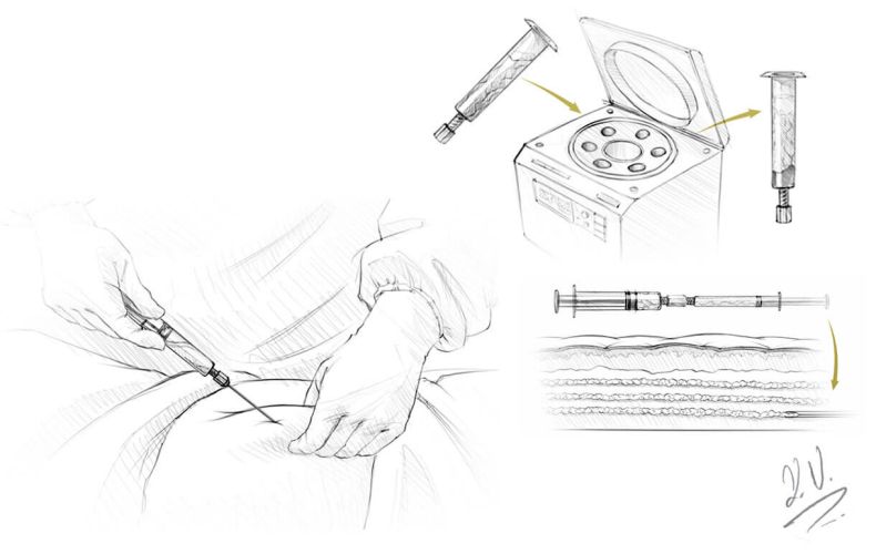 eigenfett-operation-in-zug