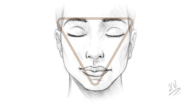 facial contouring with fillers