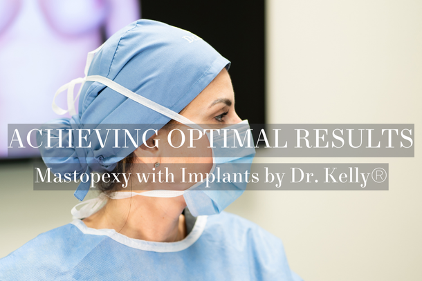 OPTIMALE ERGEBNISSE ERREICHEN